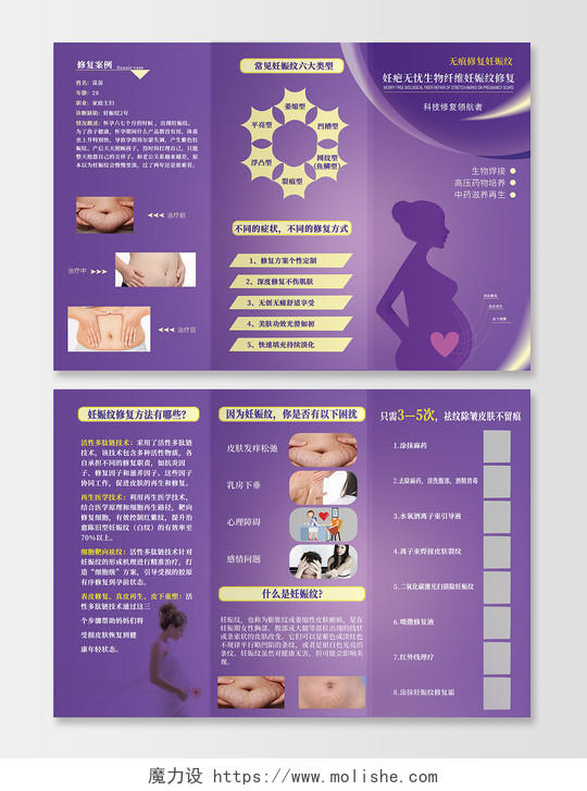 紫色女性健康妊娠纹产后肥胖三折页